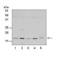 RPS7 | Ribosomal protein S7 (chloroplastic) in the group Antibodies Plant/Algal / DNA/RNA/Cell Cycle / Translation at Agrisera AB (Antibodies for research) (AS15 2877)